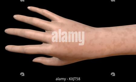Aging Hand,  skin , age spots lighter spots  surface color. 3d rendering Stock Photo