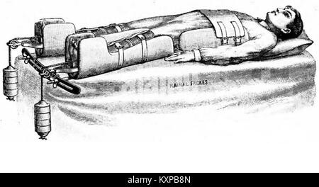 Illustrated page from Rainal Frères corset catalogue, figure 1844, showing 19th-century corset styles and women's fashion. Stock Photo