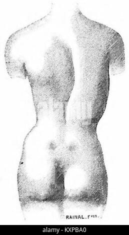 Page from a corset catalogue by Rainal Frères, showing styles, measurements, and design details of early 20th-century corsetry. Stock Photo