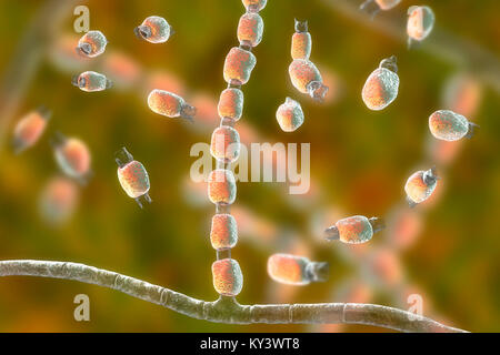 Coccidioidomycosis fungus. Computer illustration of thick-walled arthroconidia and arthrospores from the fungus Coccidioides immitis. This fungus is found in desert and semi-arid regions, and is endemic to south-western USA, Mexico and South America. C. immitis is the causative agent of coccidioidomyocosis, also known as valley fever. The route of infection is almost always pulmonary, by inhalation of the spores. Agricultural workers are particularly at risk. Symptoms include a cough, chest pain, fever, rash and fatigue. Treatment is by antibiotic and antifungal drugs. Stock Photo