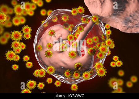 Human immunodeficiency viruses (HIV) infecting human embryo, conceptual illustration. The embryo is 4 weeks old. Stock Photo