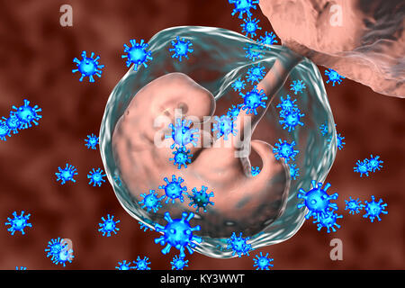 Viruses infecting human embryo, conceptual illustration. The embryo is 4 weeks old. Many viruses cause fetal abnormalities or stillbirth. For example, rubella, herpes and cytomegalovirus cause different fetal pathology, whilst fetal measles infection usually leads to stillbirth. Stock Photo