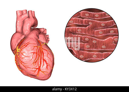 Heart,computer illustration.The heart is a hollow sac (lower frame) of muscular tissue that pumps blood around the body.Small surface coronary blood vessels supply the heart muscle with blood.Four major blood vessels (upper frame) bring blood to and from the heart.From upper left to centre right they are: the vena cava (the vein returning deoxygenated blood from the body); the aorta (artery through which oxygenated blood is pumped to the body); the pulmonary artery (through which deoxygenated blood is pumped to the lungs) Stock Photo