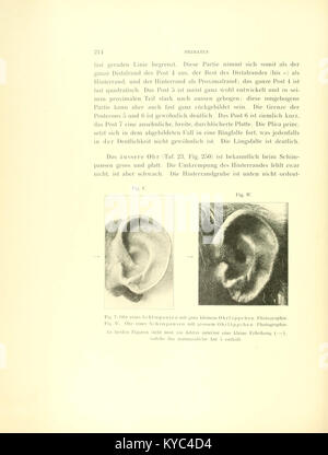 Shell Of An Ear An anatomical illustration showing the cartilage and outer ear ...