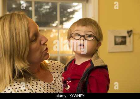 Suwanee, GA, USA. 15th Jan, 2018. Zach Ehlers, 2, has Dpwn syndrome and required eye surgery for cataracts. He has developmental challenges typical of Trisomy 21, the genetic name for the chromosome abnormality. It is a genetic disorder caused by the presence of all or part of a third copy of chromosome and is typically associated with physical growth delays, characteristic facial features and mild to moderate intellectual disability. The average IQ of a young adult with Down syndrome is 50, equivalent to the mental ability of an 8- or 9-year-old child, but this can vary widely.Pictured: Zac Stock Photo