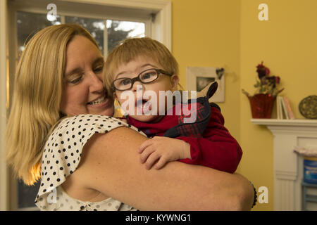 Suwanee, GA, USA. 15th Jan, 2018. Zach Ehlers, 2, has Dpwn syndrome and required eye surgery for cataracts. He has developmental challenges typical of Trisomy 21, the genetic name for the chromosome abnormality. It is a genetic disorder caused by the presence of all or part of a third copy of chromosome and is typically associated with physical growth delays, characteristic facial features and mild to moderate intellectual disability. The average IQ of a young adult with Down syndrome is 50, equivalent to the mental ability of an 8- or 9-year-old child, but this can vary widely.Pictured: Zac Stock Photo