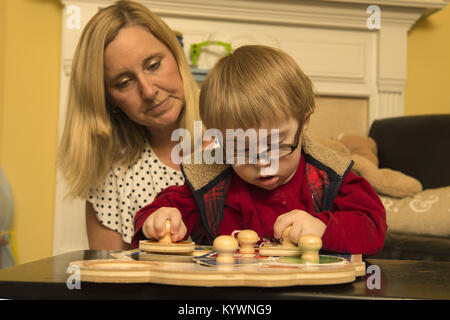 Suwanee, GA, USA. 15th Jan, 2018. Zach Ehlers, 2, has Dpwn syndrome and required eye surgery for cataracts. He has developmental challenges typical of Trisomy 21, the genetic name for the chromosome abnormality. It is a genetic disorder caused by the presence of all or part of a third copy of chromosome and is typically associated with physical growth delays, characteristic facial features and mild to moderate intellectual disability. The average IQ of a young adult with Down syndrome is 50, equivalent to the mental ability of an 8- or 9-year-old child, but this can vary widely.Pictured: Zac Stock Photo