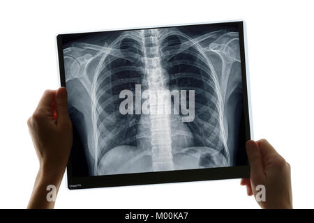 Examination of a Chest X-ray Stock Photo