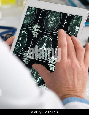 MODEL RELEASED. Doctor viewing brain scans on a digital tablet. Stock Photo