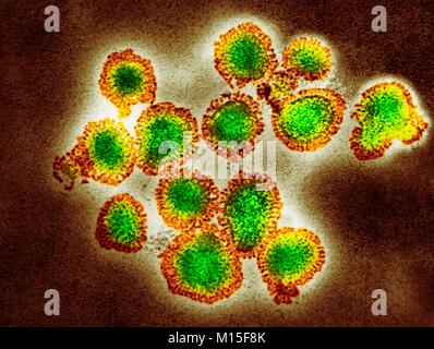 H3N2 influenza virus particles, coloured transmission electron micrograph (TEM). Each virus consists of a nucleocapsid (protein coat) that surrounds a core of RNA (ribonucleic acid) genetic material. Surrounding the nucleocapsid is a lipid envelope that contains the glycoprotein spikes haemagglutinin (H) and neuraminidase (N). These viruses were part of the Hong Kong Flu pandemic of 1968-1969 that killed approximately one million worldwide. H3N2 viruses are able to infect birds and mammals as well as humans.