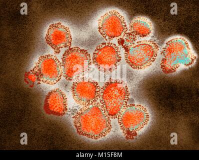 H3N2 influenza virus particles, coloured transmission electron micrograph (TEM). Each virus consists of a nucleocapsid (protein coat) that surrounds a core of RNA (ribonucleic acid) genetic material. Surrounding the nucleocapsid is a lipid envelope that contains the glycoprotein spikes haemagglutinin (H) and neuraminidase (N). These viruses were part of the Hong Kong Flu pandemic of 1968-1969 that killed approximately one million worldwide. H3N2 viruses are able to infect birds and mammals as well as humans. Stock Photo