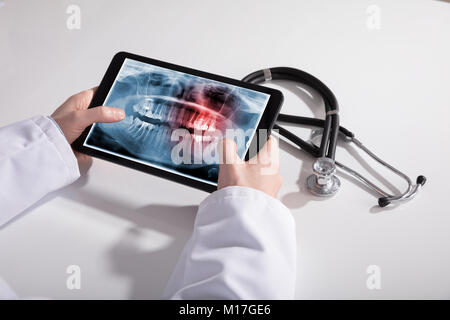 Doctor's Hand And Digital Tablet Screen Showing Teeth X-ray With Stethoscope On White Desk Stock Photo