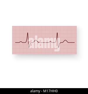 Heart Rate or a Heartbeat on a plotting paper. Cardiogram of the heart on a graph paper. Cardiogram of a healthy heart. Vector illustration isolated o Stock Vector