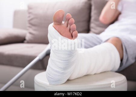 Close-up Photo Of A Man's Plastered Leg Stock Photo