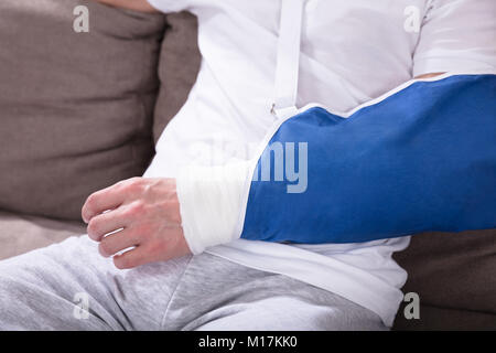 Close-up Photo Of A Fractured Man's Hand Stock Photo