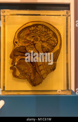 Vertical cross section of a human skull on display in the National Museum of Health and Medicine, Silver Spring, MD, USA. Stock Photo