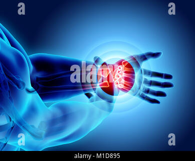 Wrist painful - skeleton x-ray, 3D Illustration medical concept. Stock Photo