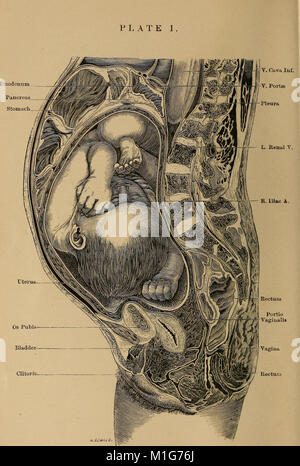 A treatise on the science and practice of midwifery (1878) (14596588467) Stock Photo