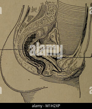 A reference hand-book of gynecology for nurses (1913) (14773768294) Stock Photo