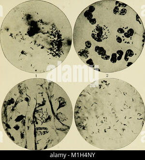 A manual of the modern theory and technique of surgical asepsis (1895) (14782671495) Stock Photo