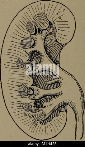 A reference hand-book of gynecology for nurses (1913) (14773840914) Stock Photo