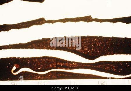 Photograph of a mature beef tapeworm (Taenia saginata), with a typical length of 5 meters and visible strobila segmentation with reproducible proglottids, 1979. Image courtesy CDC. () Stock Photo