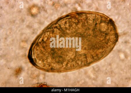 photomicrograph of a Paragonimus westermani trematode egg Stock Photo ...