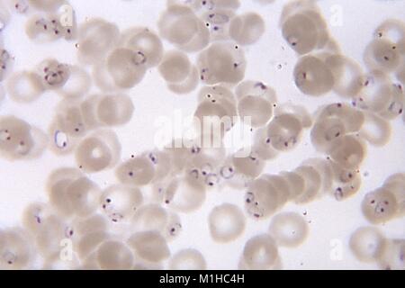 Plasmodium falciparum rings found in a blood smear micrograph, 1967. Image courtesy Centers for Disease Control (CDC) / Dr. Greene. () Stock Photo