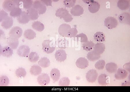 Plasmodium falciparum rings found in a blood smear micrograph, 1971. Image courtesy Centers for Disease Control (CDC) / Dr. Mae Melvin. () Stock Photo