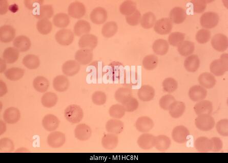 Infected RBCs with Plasmodium vivax, revealed on a thin micrograph film, 1973. Image courtesy Centers for Disease Control (CDC) / Dr Mae Melvin. () Stock Photo