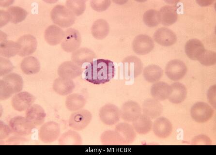 Photomicrograph of the malaria causing parasite Plasmodium Vivax in its macrogametocyte stage, on a blood smear, magnified 1250 times, 1970. Image courtesy CDC. () Stock Photo