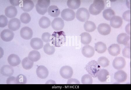 File:Microphotographs of Plasmodium vivax in Giemsa-stained thin blood  films.jpg - Wikipedia