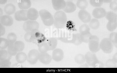 Photomicrograph of the malaria causing parasite Plasmodium vivax in immature schizont and old trophozoite forms, on a thin film blood smear magnified 1125 x, 1966. Image courtesy CDC/Dr. Mae Melvin. () Stock Photo