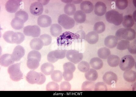 Photomicrograph of the malaria causing parasite Plasmodium vivax in its immature schizont phase, magnified 1125x, 1970. Image courtesy CDC. () Stock Photo