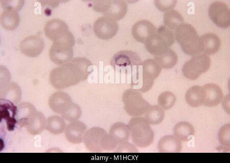 Photomicrograph of the malaria parazite Plasmodium ovale in its trophozoite phase, within a slightly oval red blood cell, on thin film blood smear, 1966. Image courtesy CDC/Dr. Mae Melvin. () Stock Photo