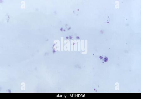 Photomicrograph of the malaria parasite Plasmodium vivax in trophozoite phase without Schuffner's dots, on thick film, magnified 1125 x, 1973. Image courtesy CDC/Dr. Mae Melvin. () Stock Photo