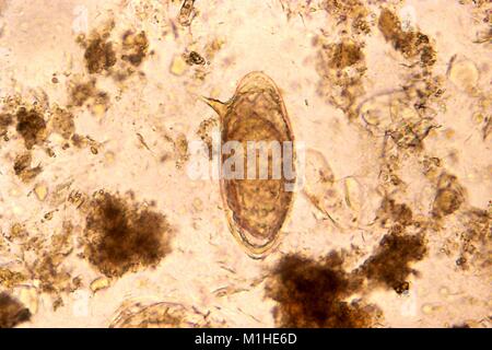 Schistosoma mansoni egg Stock Photo - Alamy