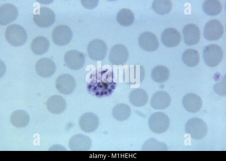 Photomicrograph of the malaria parasite Plasmodium vivax in its mature schizont phase with 18 merozoites, on thin blood smear magnified 1125 x, 1965. () Stock Photo