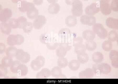 Photomicrograph of the malaria parasite Plasmodium vivax in two ring forms with different morphological characteristics, on thin blood smear magnified 1125 x, 1966. Image courtesy CDC/Dr. Mae Melvin. () Stock Photo