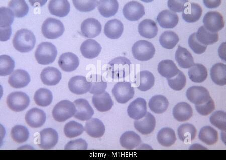 Photomicrograph of a double infected red blood cell with the malaria parasite Plasmodium vivax, in its ring form of development, on a thin blood smear magnified 1125 x, 1965. Image courtesy CDC/ Dr. Mae Melvin. () Stock Photo