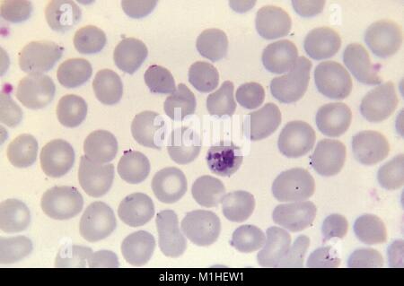 Malaria parasite revealed in a debris of red blood cell using Giemsa stain, 1967. Image courtesy Centers for Disease Control (CDC) / Dr Mae Melvin. () Stock Photo
