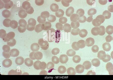 Photomicrograph of the malaria parasite Plasmodium ovale in its young immature schizont stage, 1973. Image courtesy CDC/Dr. Mae Melvin. () Stock Photo