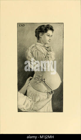 An American text-book of obstetrics. For practitioners and students (1897) (14764753051) Stock Photo