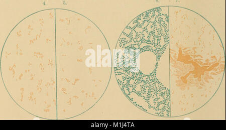 An American text-book of the diseases of children (1895) (14759400076 ...