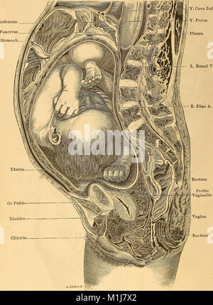 A treatise on the science and practice of midwifery (1880) (14741176606) Stock Photo