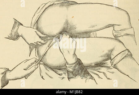 A system of midwifery, including the diseases of pregnancy and the puerperal state (1875) (14786517893) Stock Photo