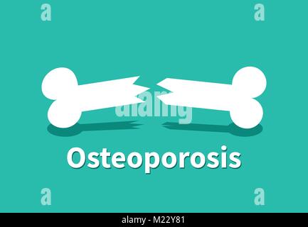 Osteoporosis, Broken bone in vector art design Stock Vector