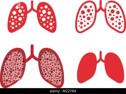 Set of lung cancer icons in vector art design Stock Vector