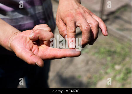 Jixi, Heilongjiang, China. 4th July, 2017. A resident shows the silver graphite dust which settles on all surfaces and is said to pollute air and groundwater. Credit: Dave Tacon/ZUMA Wire/ZUMAPRESS.com/Alamy Live News Stock Photo