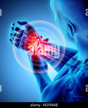 Wrist painful - skeleton x-ray, 3D Illustration medical concept. Stock Photo